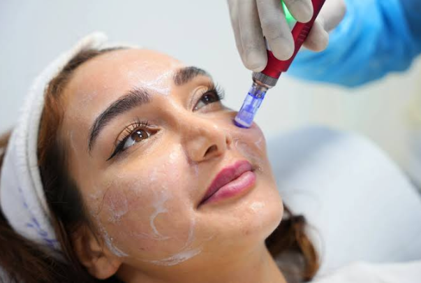 Ready to Refresh Your Appearance? What You Need to Know About Facial Rejuvenation in Dubai